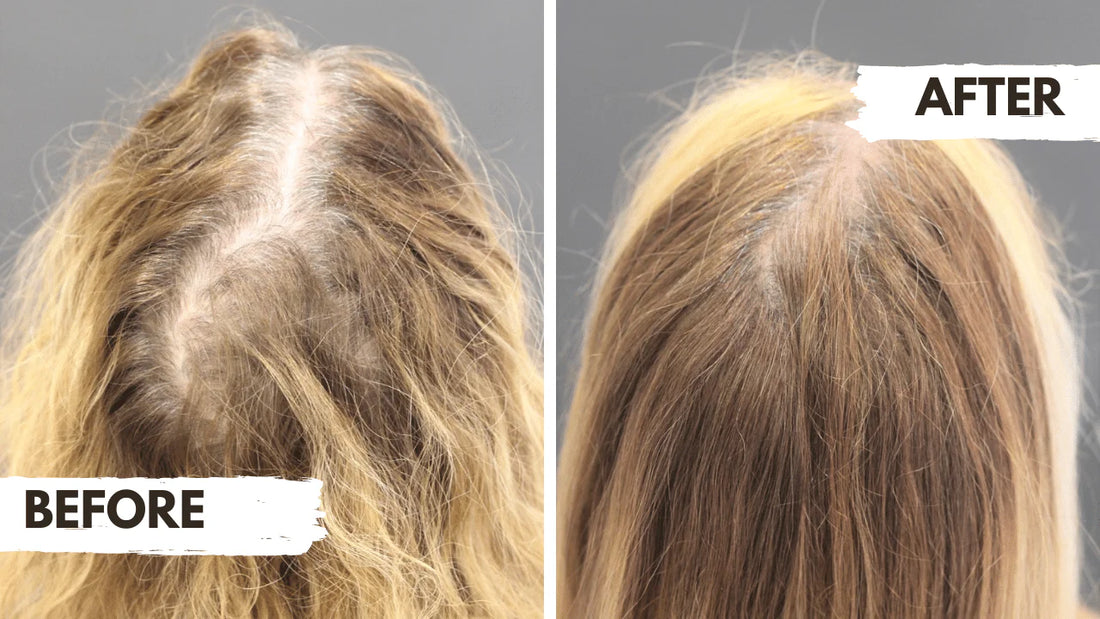 Before and after comparison of hair treatment on a person's head.