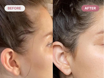 Before and after comparison of hair styling on a person's head.